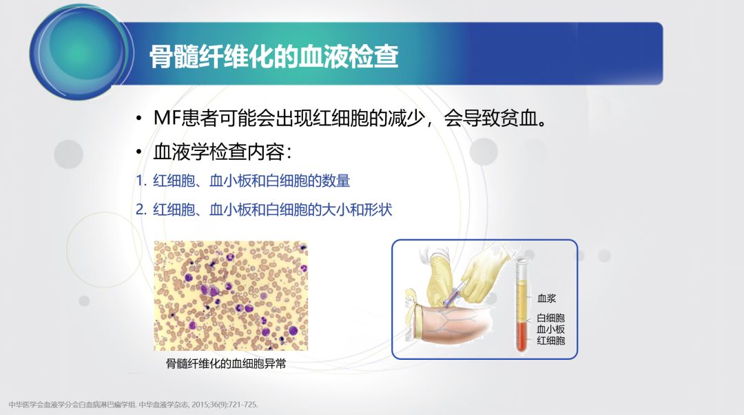 骨髓纤维化最新疗法突破，带来治疗的新希望